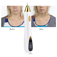 Mole and Freckle Removal Pen with LCD